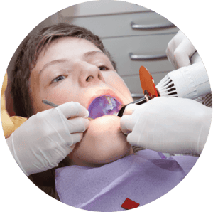 Sealants
