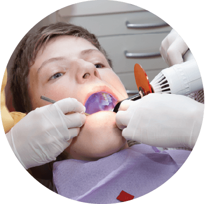 Sealants